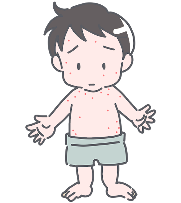 水ぶくれの治療